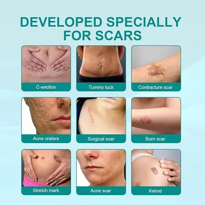 Medical Scar Removal Spray