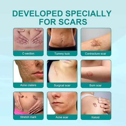 Medical Scar Removal Spray