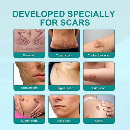 Medical Scar Removal Spray